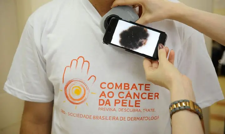 Guia procura esclarecer relação entre covid-19 e lesões de pele